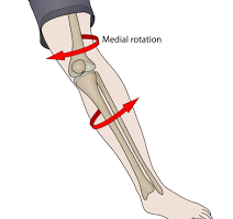 knee twisting injury
