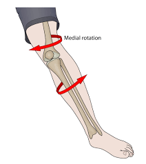 knee twisting injury