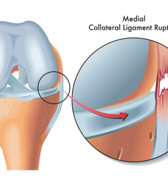 medial collateral ligament