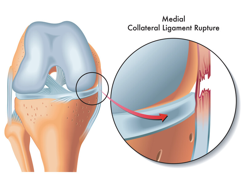 medial collateral ligament