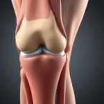 - Medial knee pain differential diagnosis