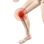 Knee Instability Signs