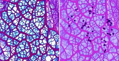 Microscopic comparison of collagen production in younger versus older MCL tissue showing age impact on MCL sprain healing time