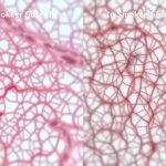 Microscopic view showing differences in collagen formation between smokers and non-smokers during MCL sprain healing timeline