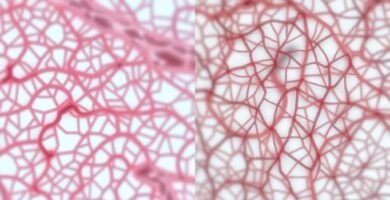 Microscopic view showing differences in collagen formation between smokers and non-smokers during MCL sprain healing timeline