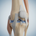 What is the difference between MCL tear and sprain?